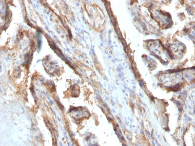 FFPE human placenta sections stained with 100 ul anti-Galectin-13 (clone PP13/1161) at 1:400. HIER epitope retrieval prior to staining was performed in 10mM Citrate, pH 6.0 or 10mM Tris 1mM EDTA, pH 9.0.